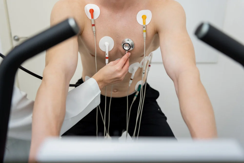 An individual with multiple ECG electrodes attached to their torso.